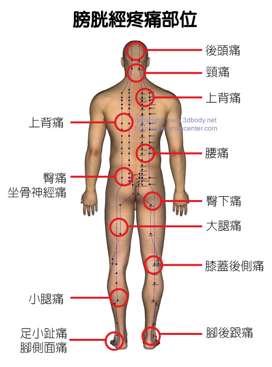 身体常见的疼痛及相关经络穴位分部图
