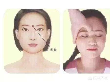 二羊问答：失眠怎么办？治疗失眠的最好最好方法的穴位