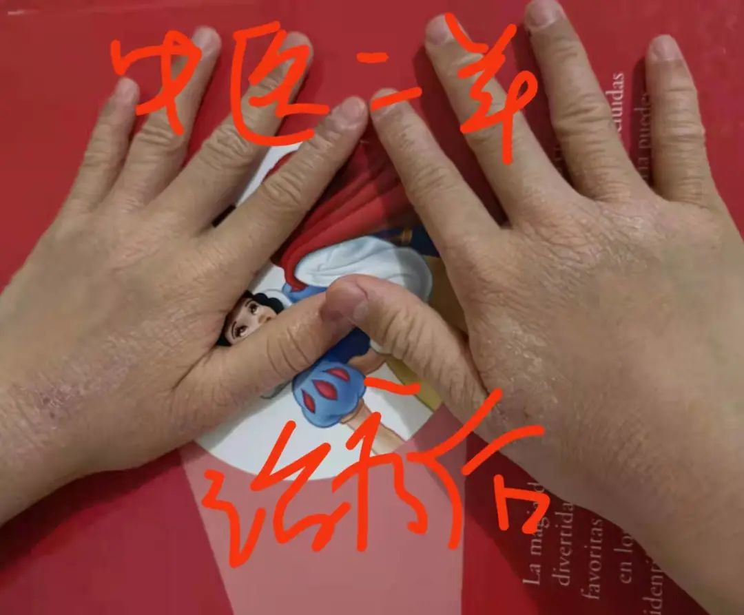中医二羊案：反复湿疹11年，头面脖子双手流水，中药三月好转
