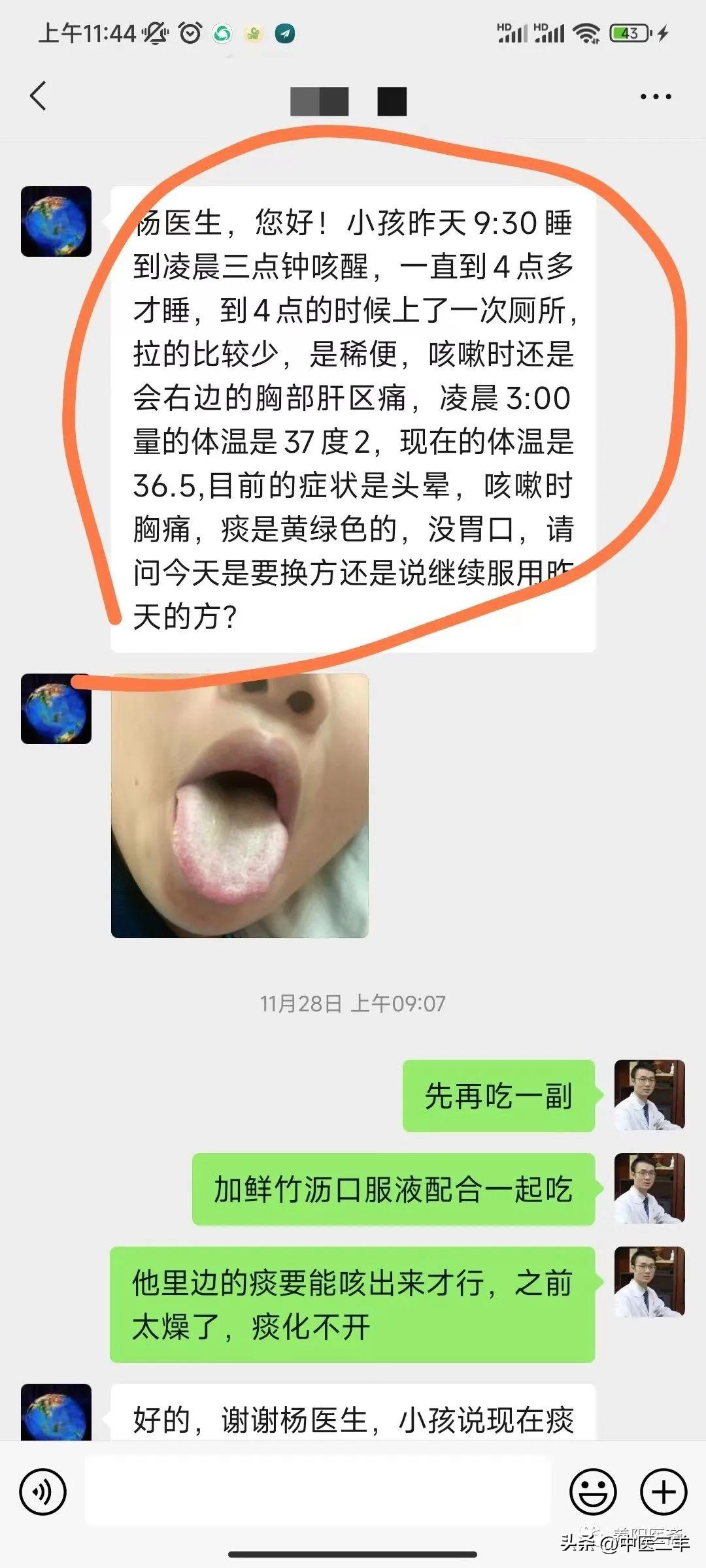 支原体流感顽固反复发烧咳嗽！纯中医奋战一个多月的经验总结