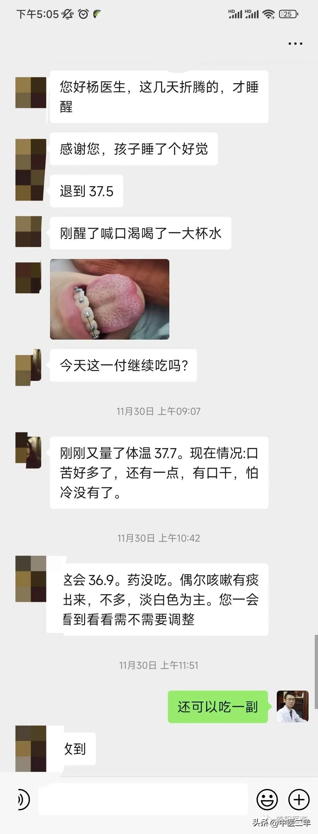 支原体流感顽固反复发烧咳嗽！纯中医奋战一个多月的经验总结